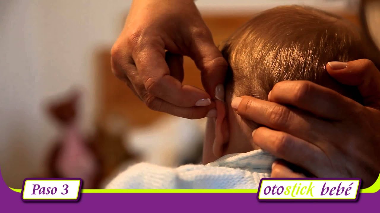 Método de colocación Otostick Bebé