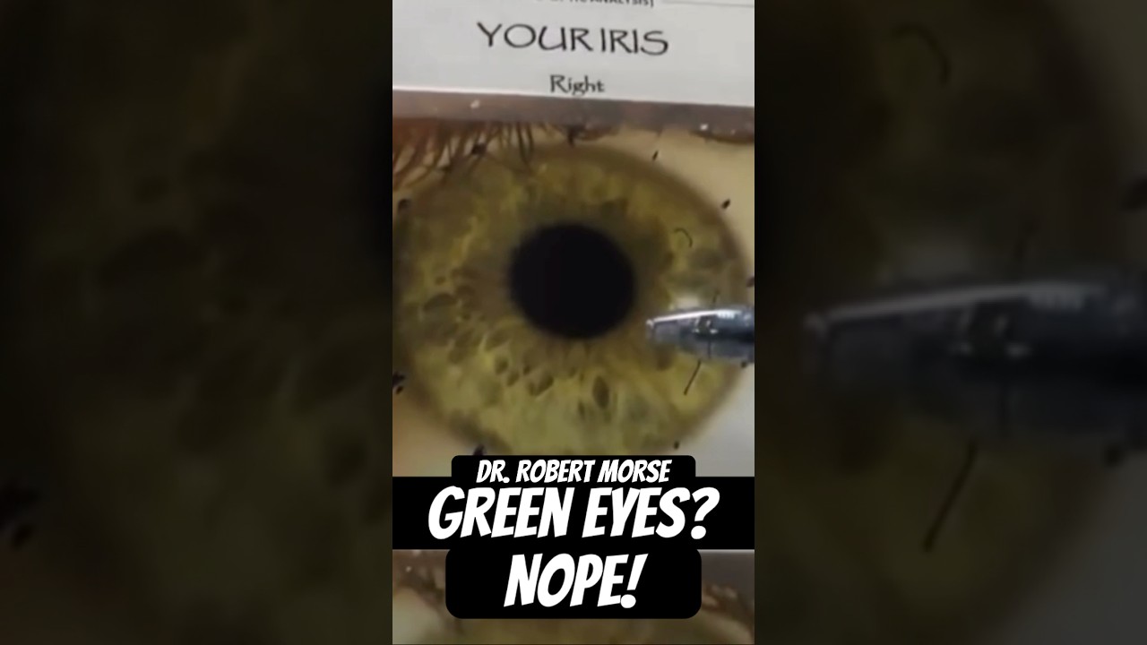 What color are your eyes? There are only blue or brown 👀 #greeneyes #eyecolor #iris #iridology