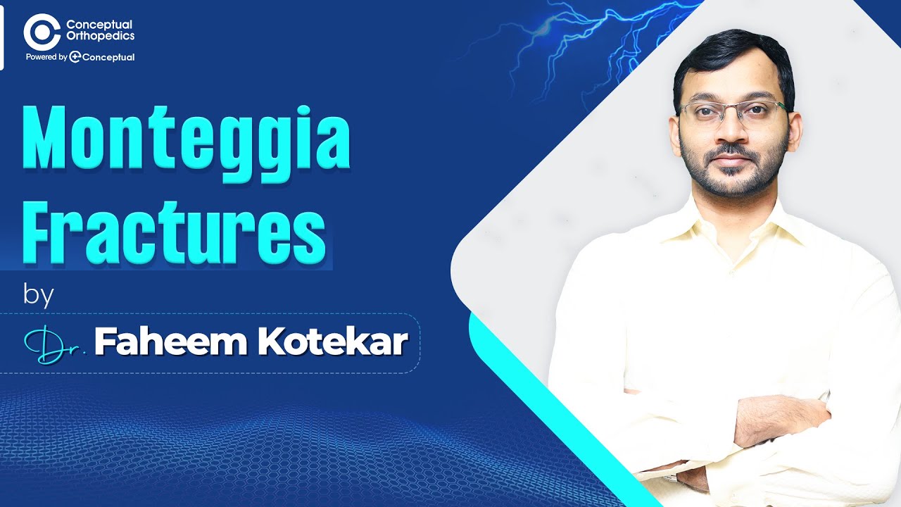 Monteggia Fractures by Dr Faheem Kotekar@ConceptualOrthopedics
