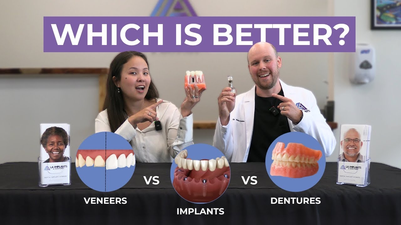 Veneers vs Implants vs Dentures: Which is Best for You? What to Know & Cost Breakdown