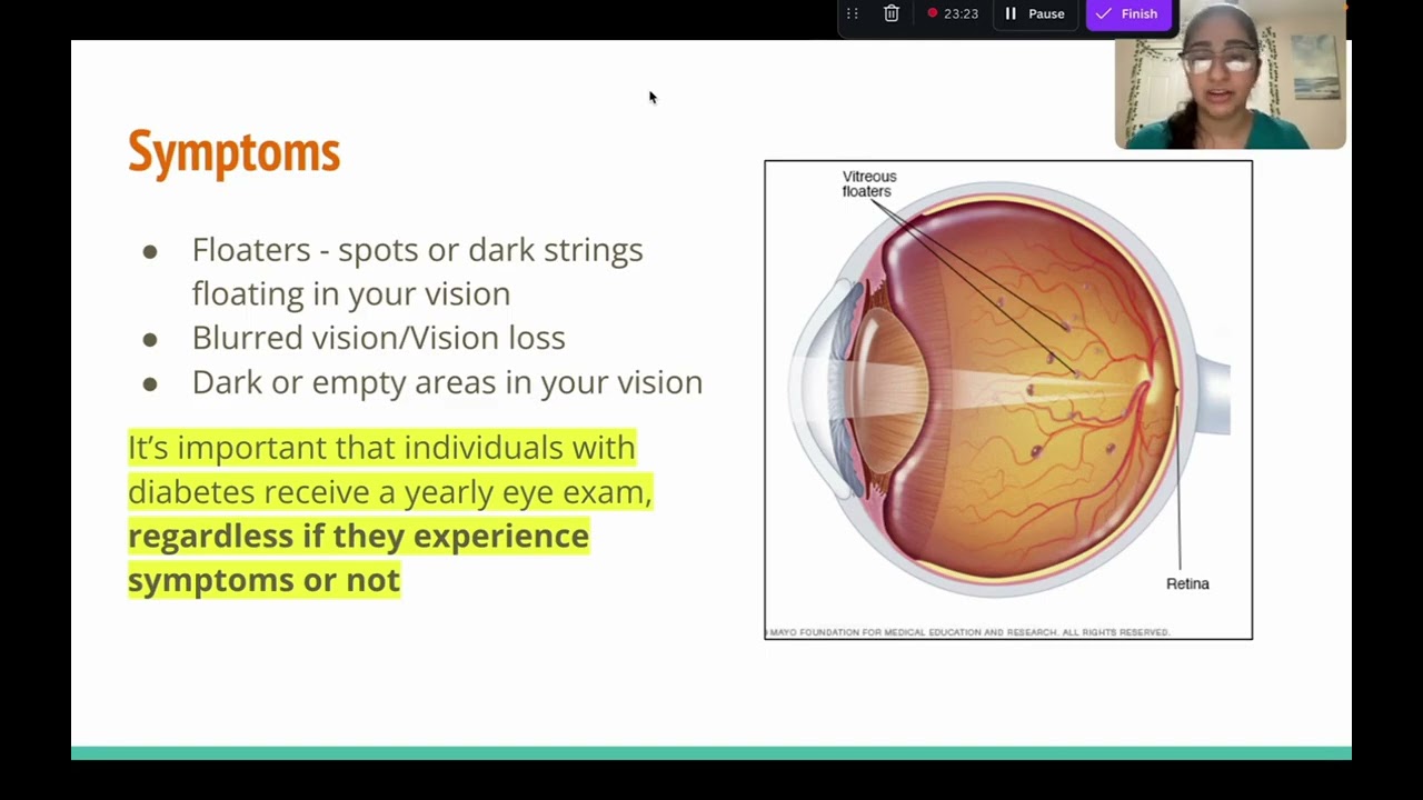 Diabetic Retinopathy Presentation 