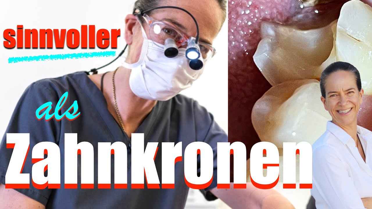 TEILKRONEN ( meist ) besser als Zahnkronen: Warum