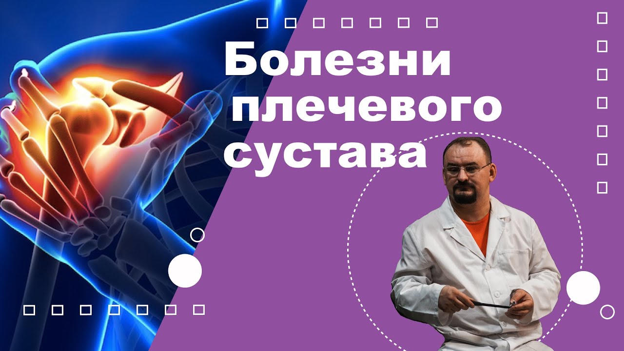 Болезни плечевого сустава