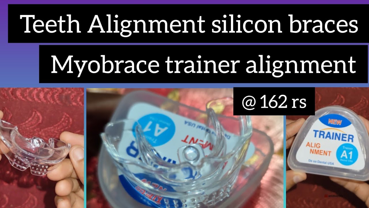 Teeth alignment silicon braces @162 rs l myobrace trainer alignment l teeth straighten