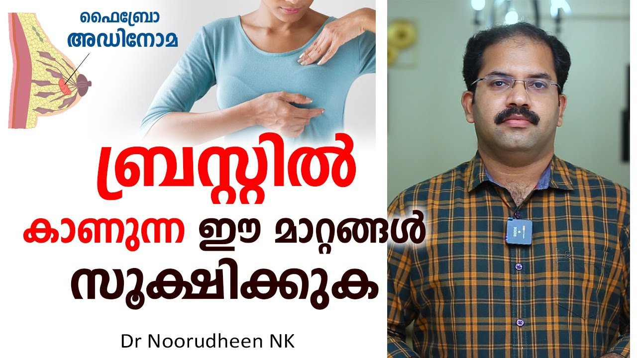 ബ്രസ്റ്റിൽ കാണുന്ന ഈ മാറ്റങ്ങൾ സൂക്ഷിക്കുക | Fibroadenoma | Dr Noorudheen NK