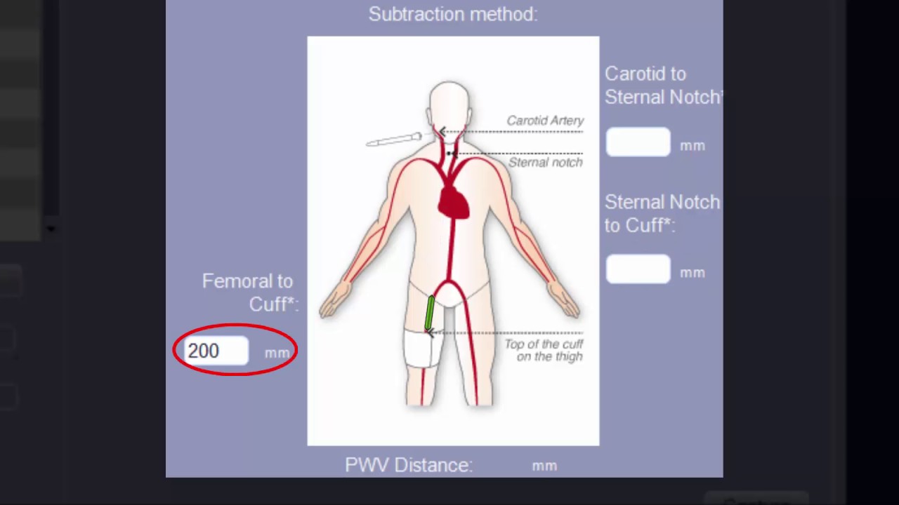 Training Video: Setting up SphygmoCor XCEL Version 1.3