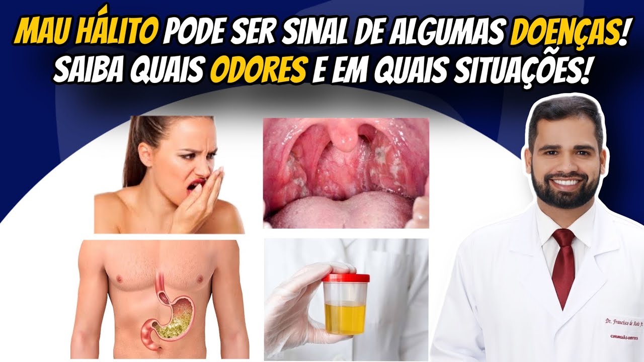 Mau hálito pode ser sinal de doenças! Saiba quais odores e quais doenças! #mauhálito #gastrite