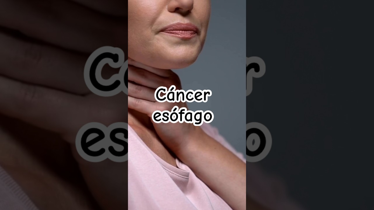 Síntomas de alerta de cáncer de esófago | Dr. William Guerrero. 