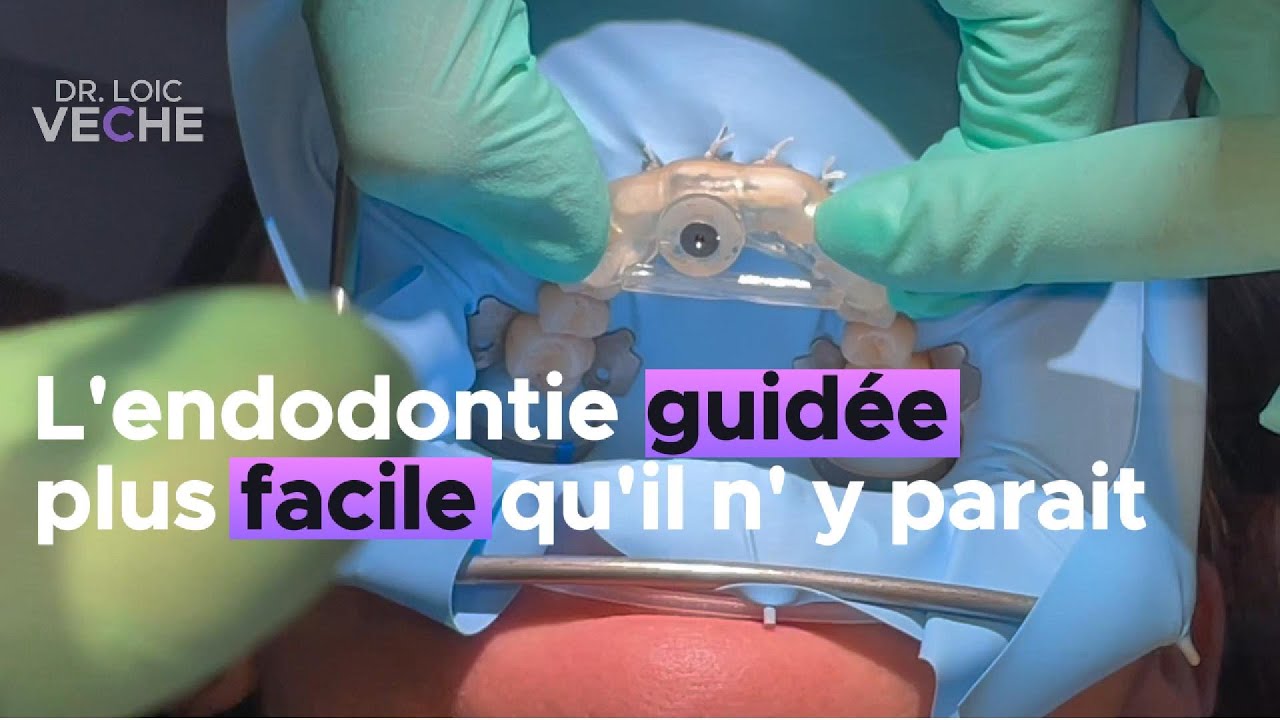 L'endodontie guid&eacute;e, plus facile qu'il n'y parait @DrLoicVeche www.lasers academy.com