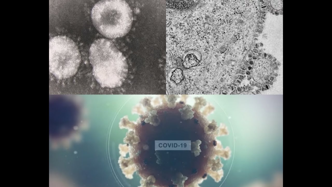 what is coronovirus? corona virus microscope footage coronavirus live real microscopes covid -19