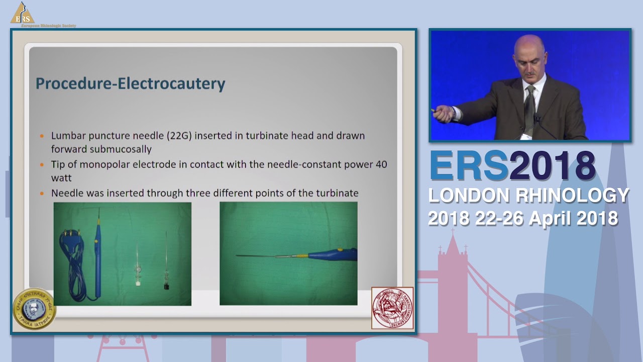 ERS London 2018, What About The Turbinates, Emmanuel Prokopakis