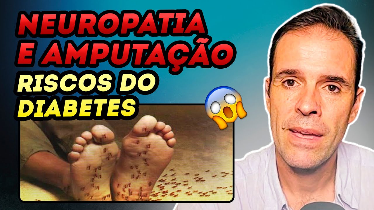 TUDO QUE O DIABÉTICO PRECISA SABER SOBRE CUIDADO COM OS PÉS