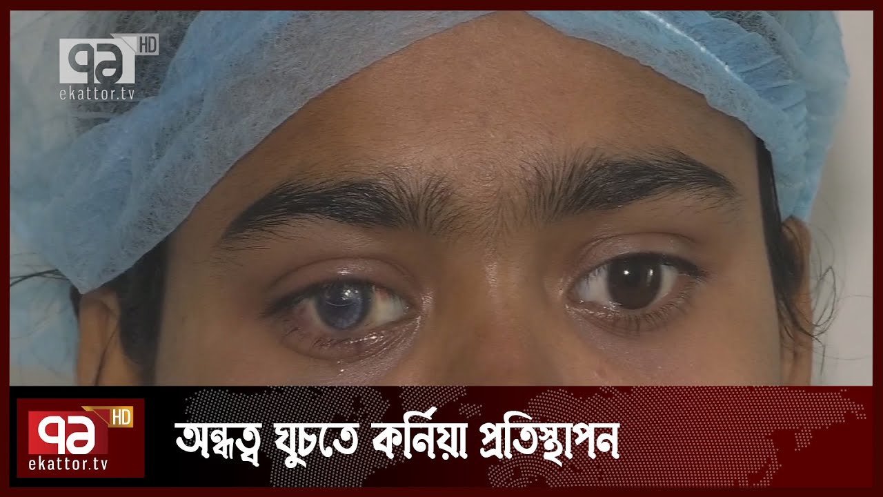 রংপুরে কর্নিয়া প্রতিস্থাপনের মাধ্যমে অন্ধত্ব থেকে মুক্তি পেয়েছেন দুইজন | News | Ekattor TV