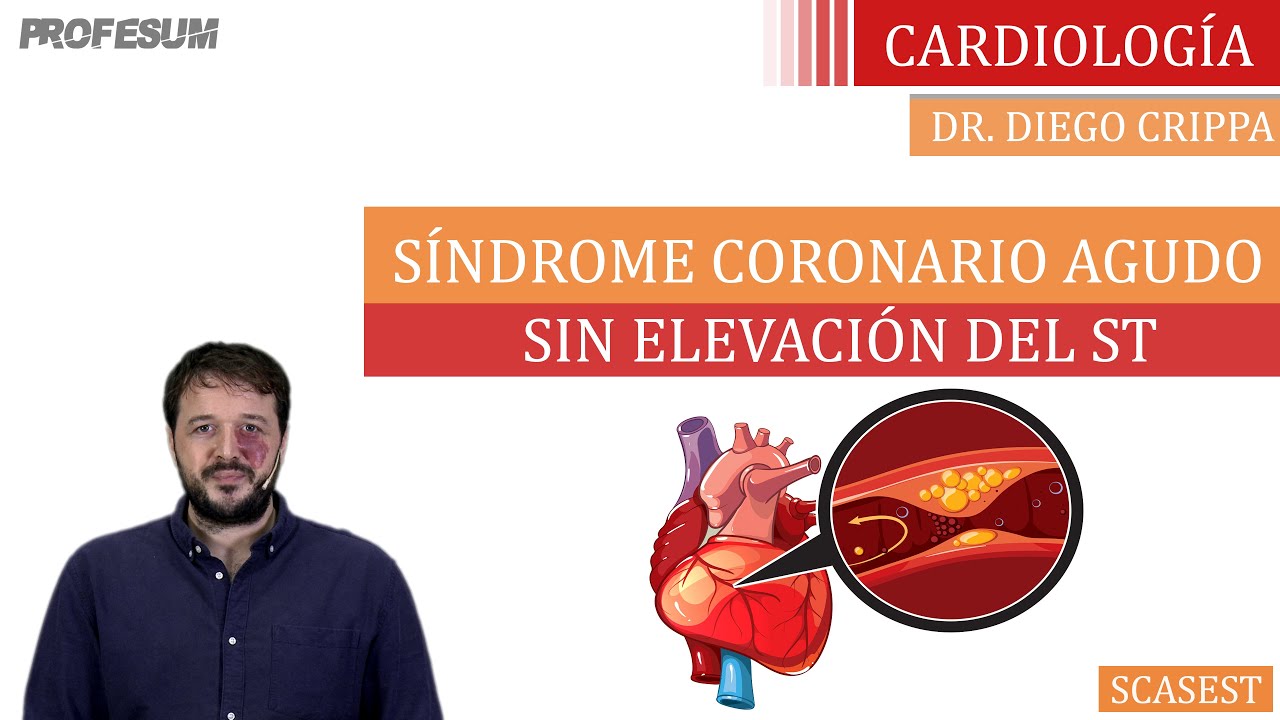 SCASEST Manejo Inicial - Dr. Diego Crippa - Trailer