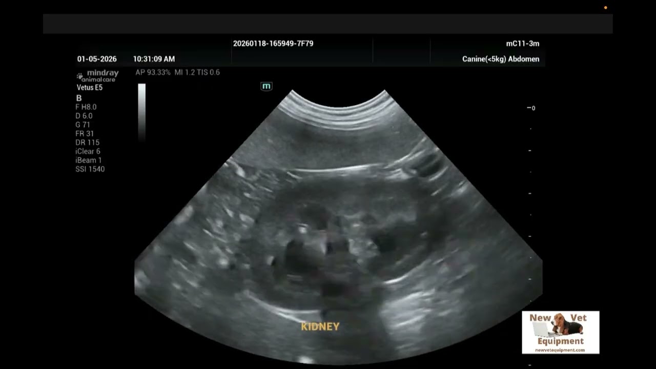 Mindray E5 Ultrasound Samples