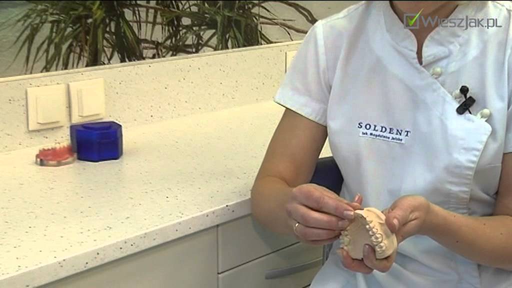 Kto może nosić licówki porcelanowe