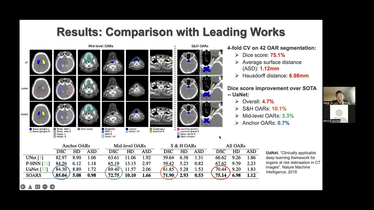 MICCAI Industrial Talk: Automated Target Volumes and Organs at Risk Segmentation