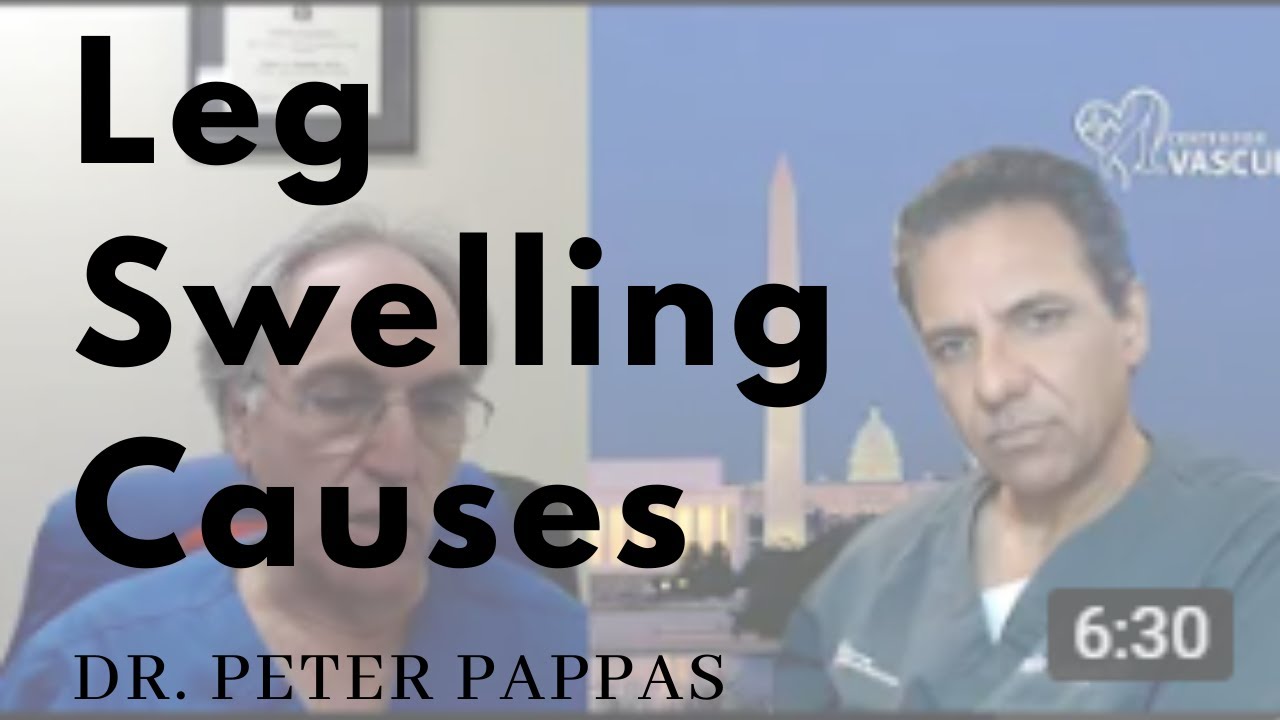 Leg Swelling Causes Explained by Dr. Peter Pappas