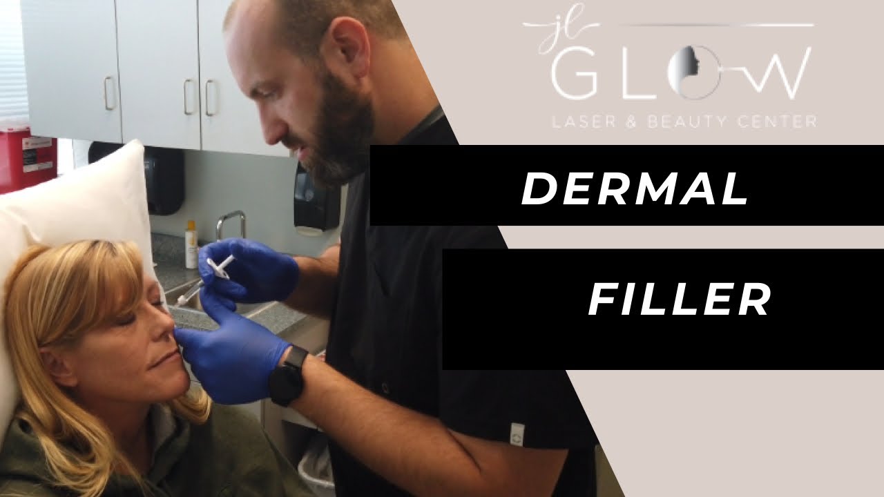 Restylane Lyft Dermal Filler Procedure & Results!