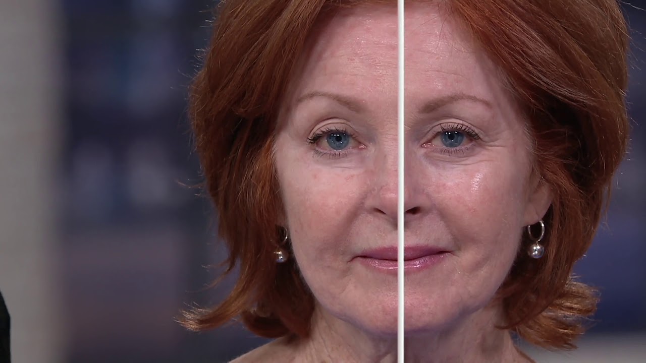 Plexaderm Set of 2 Rapid Reduction Serums on QVC