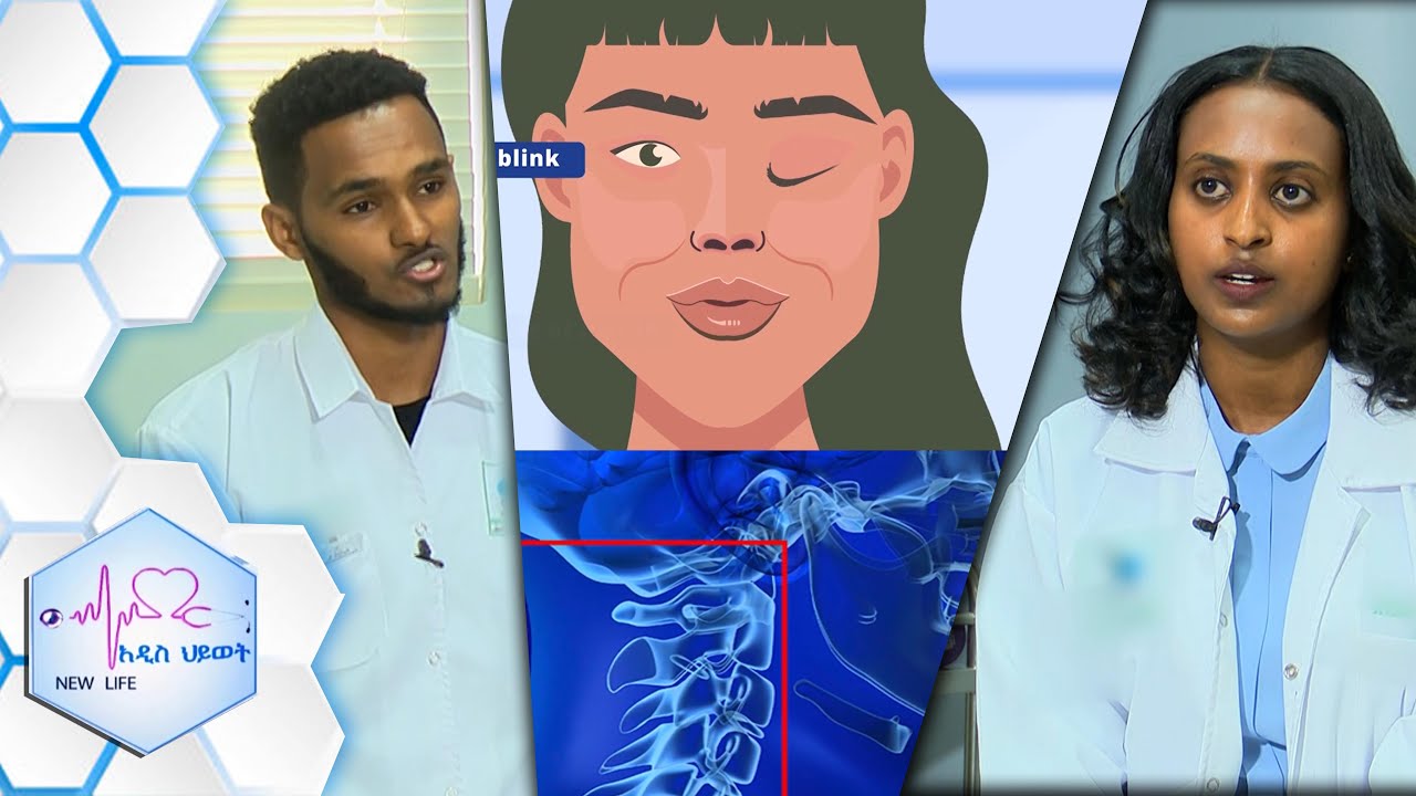 “የፊት መዞር ህመም መጋኛ አይደለም…” እና የአንገት ህመም /NEW LIFE EP 380