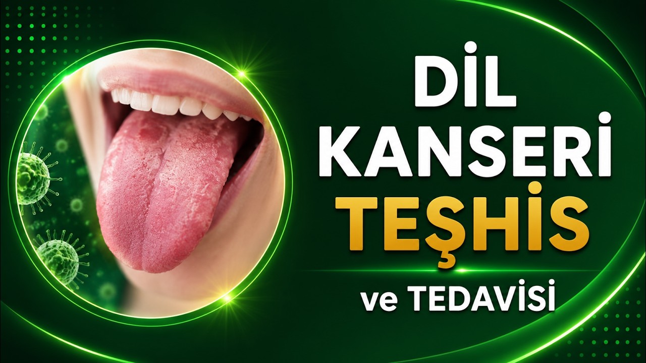 DİL KANSERİ TEŞHİS VE TEDAVİSİ