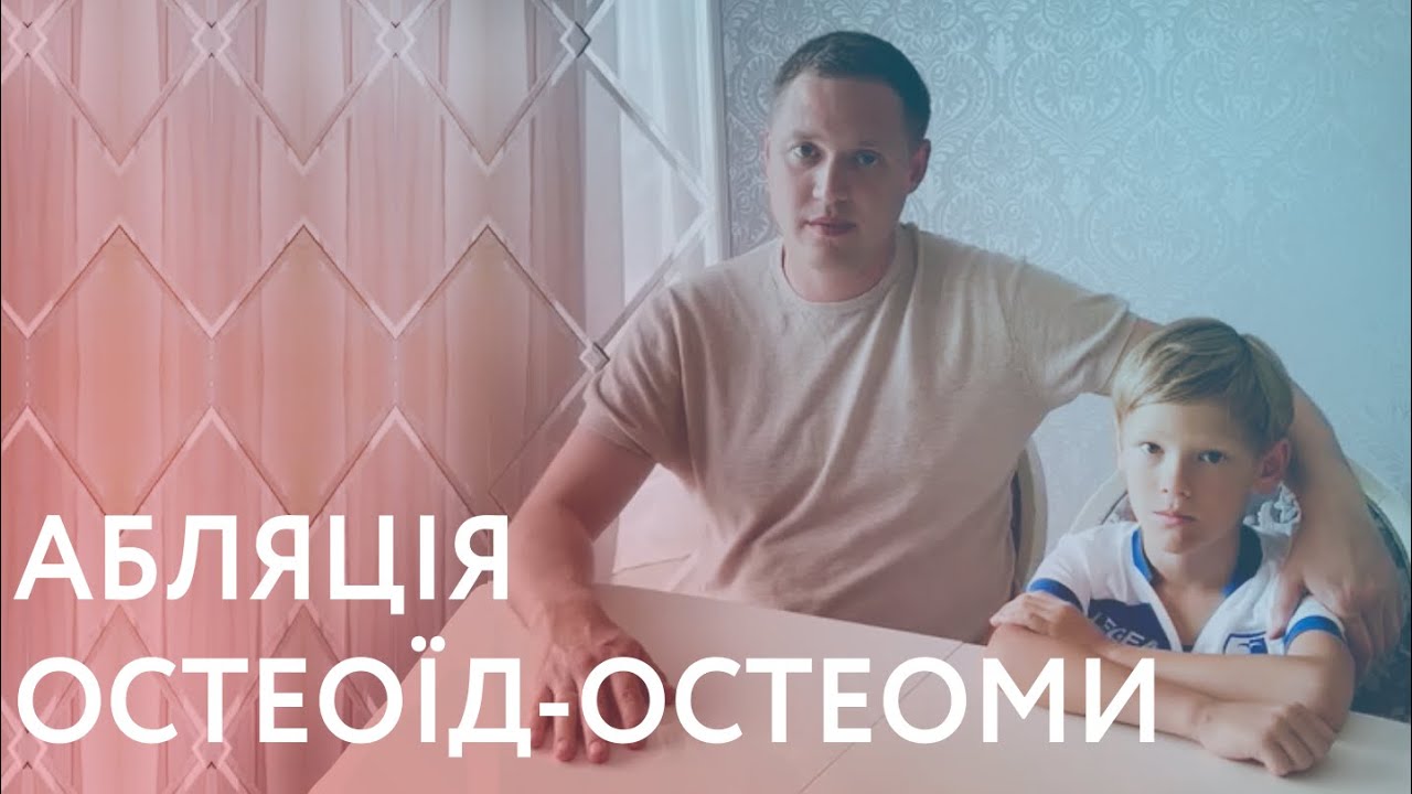 Відгук пацієнта: радіочастотна абляція остеоїд-остеоми