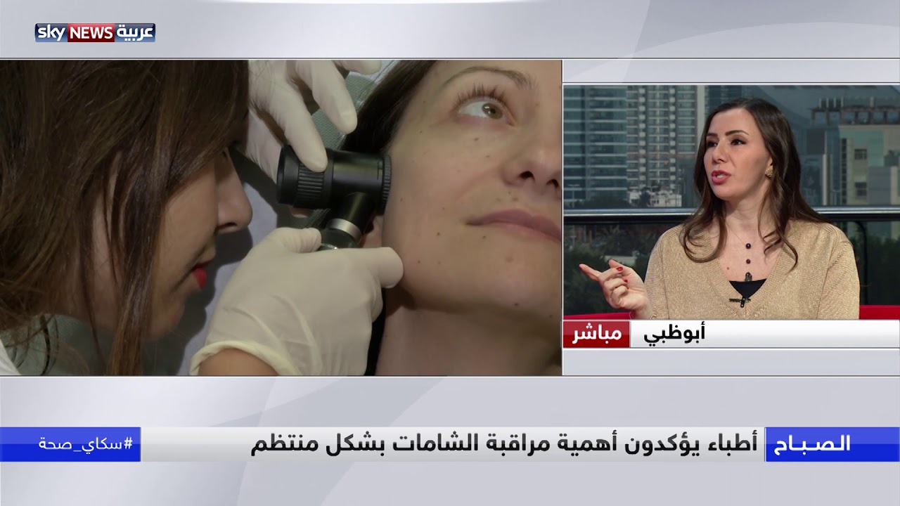 متى تتحول الشامات الحميدة إلى أورام خبيثة؟