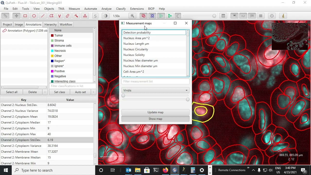 3 - Analysis | Warpy: Whole Slide Images Registration with QuPath and Fiji