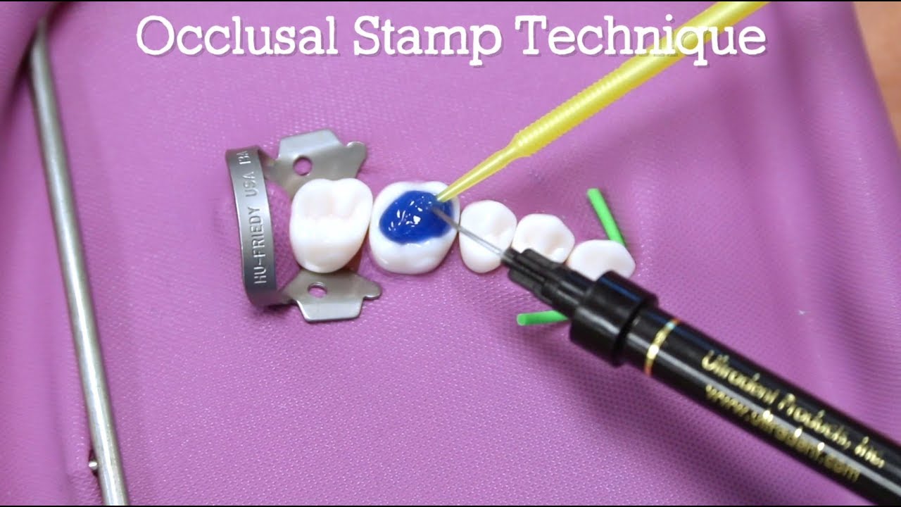 How To Do The Occlusal Stamp Technique