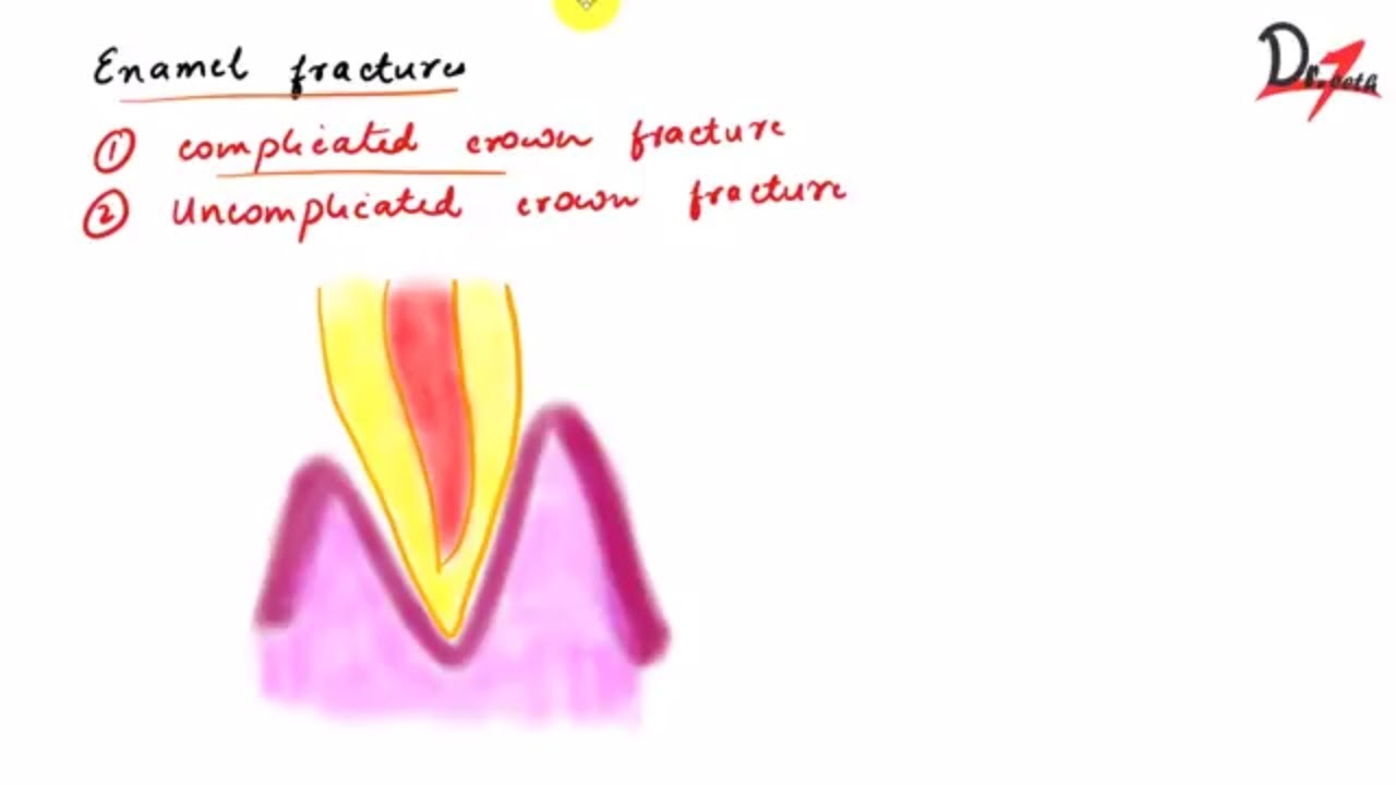 Management of Traumatic injuries of teeth: PART I