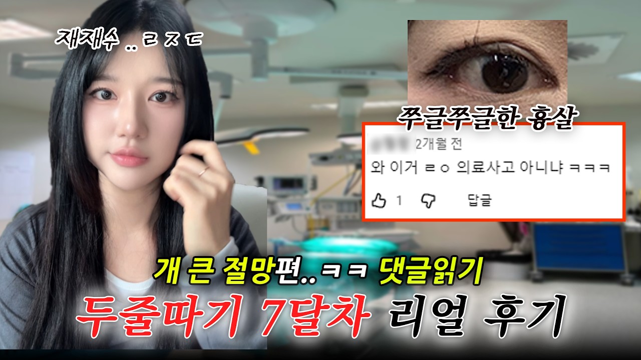 [쌍수 Q&A] 두줄따기 7개월차 리얼 후기 / 내돈내산