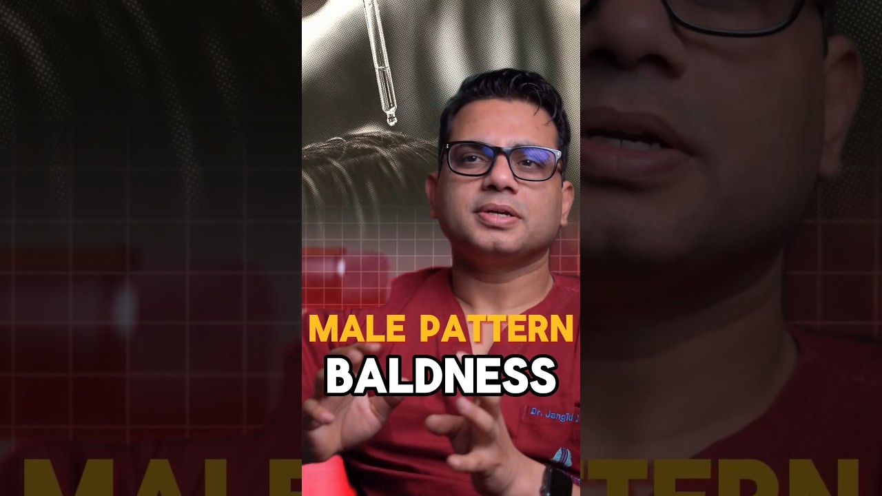 Best Medicine for Male Pattern Baldness | Dr Jangid