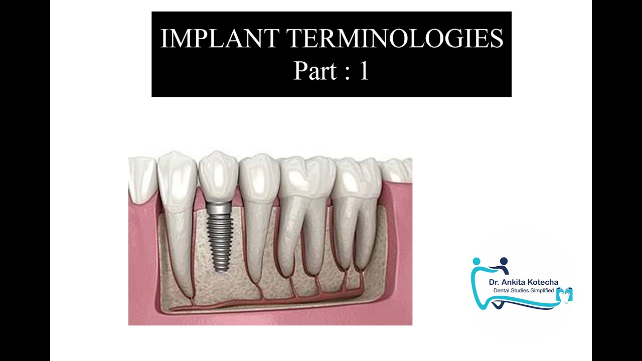 2. IMPLANT TERMINOLOGIES part 1| IMPLANTS| PERIODONTICS| DR. ANKITA KOTECHA