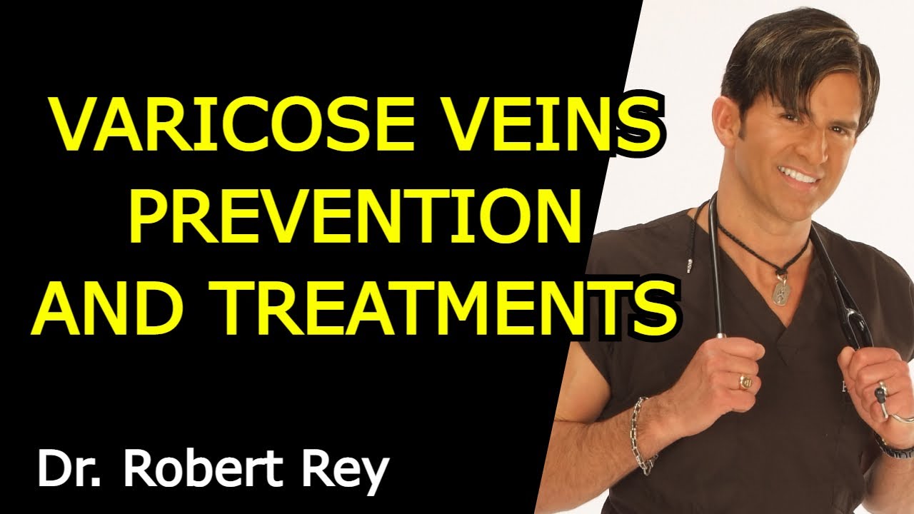 VARICOSE VEINS PREVENTION AND TREATMENTS &ndash; Dr  Robert Rey
