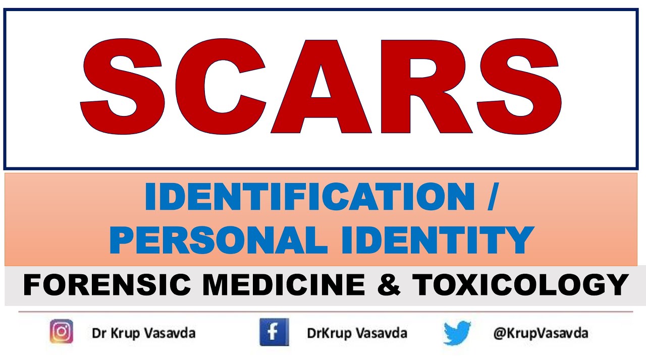 Scars | Identification | Dr Krup Vasavda