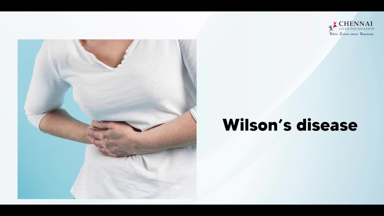 What is Wilson’s Disease? | Liver | CLF | Chennai Liver Foundation
