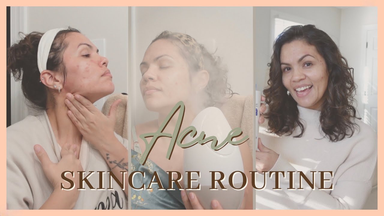 Skincare routine for adult acne, eczema, dry and sensitive skin | Oh Mother