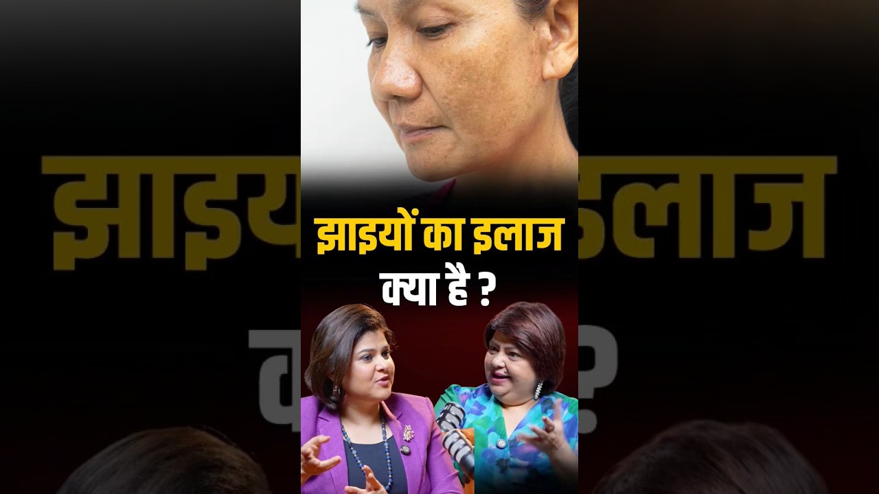 Melasma Treatment: झाइयों का ईलाज क्या है? Face Pigmentation | Dr Shehla Agarwal | #nidhivasandani