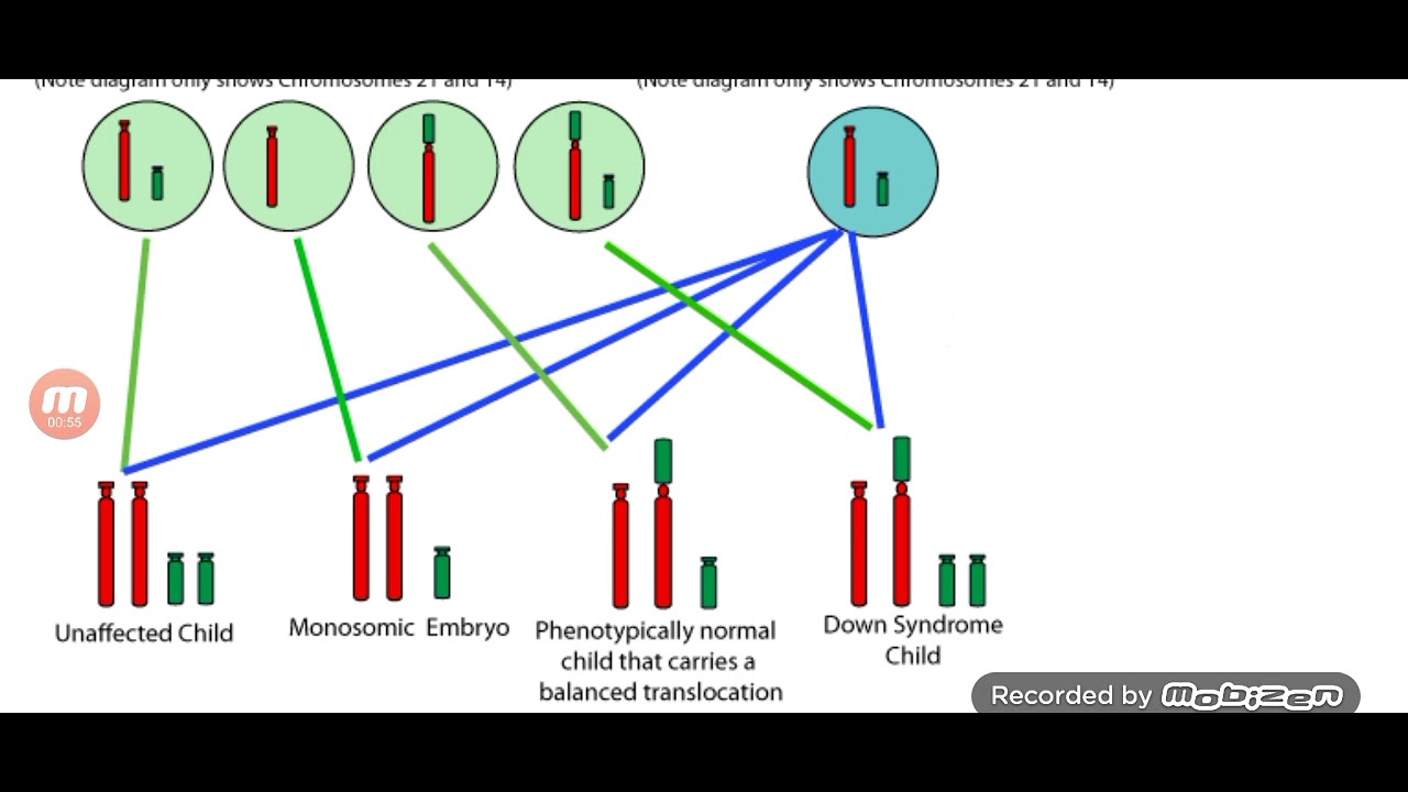 شرح ال down / translocation  جزء ٢
