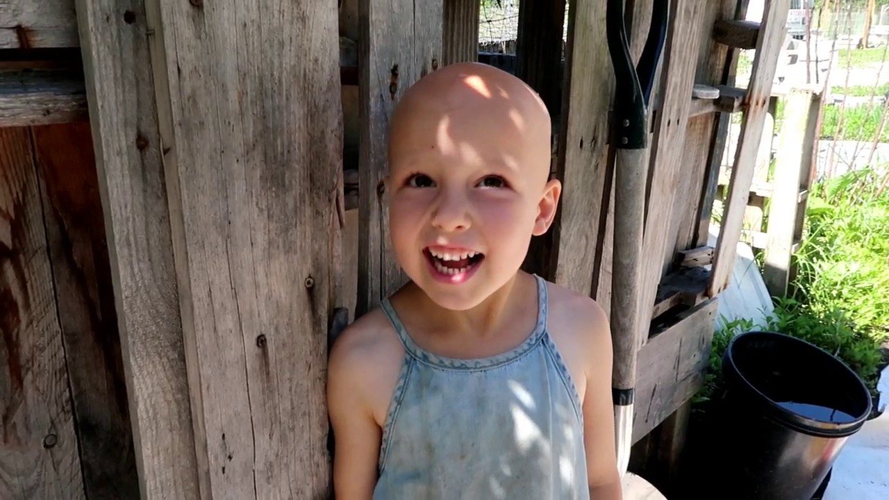 How To Get FREE Vitamin D and Healing For Autoimmune Alopecia