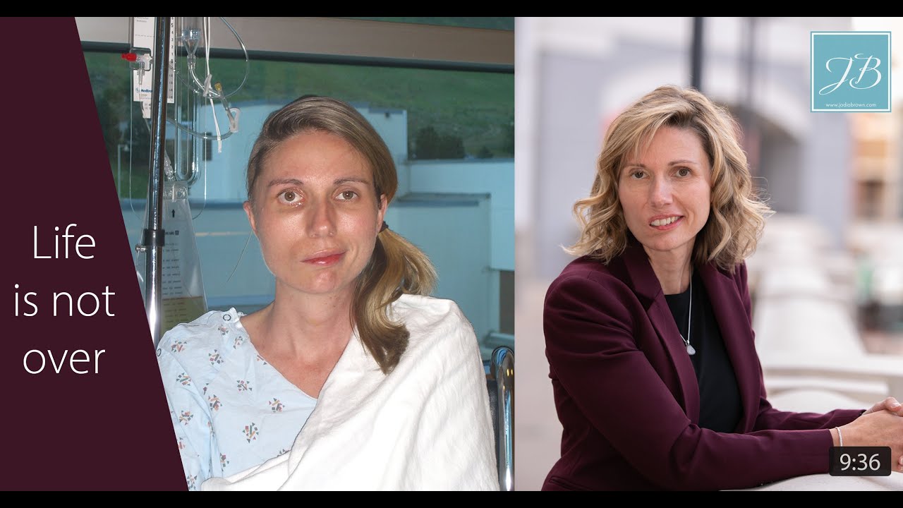 What is it like living with Facial Paralysis? Why do you look different from day to day?
