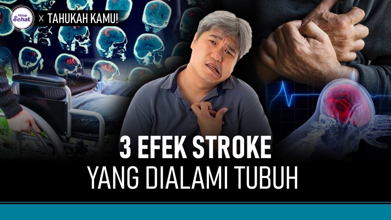 Ini 3 Hal yang Terjadi Pada Tubuh Saat Serangan Stroke | Hidup Sehat tvOne