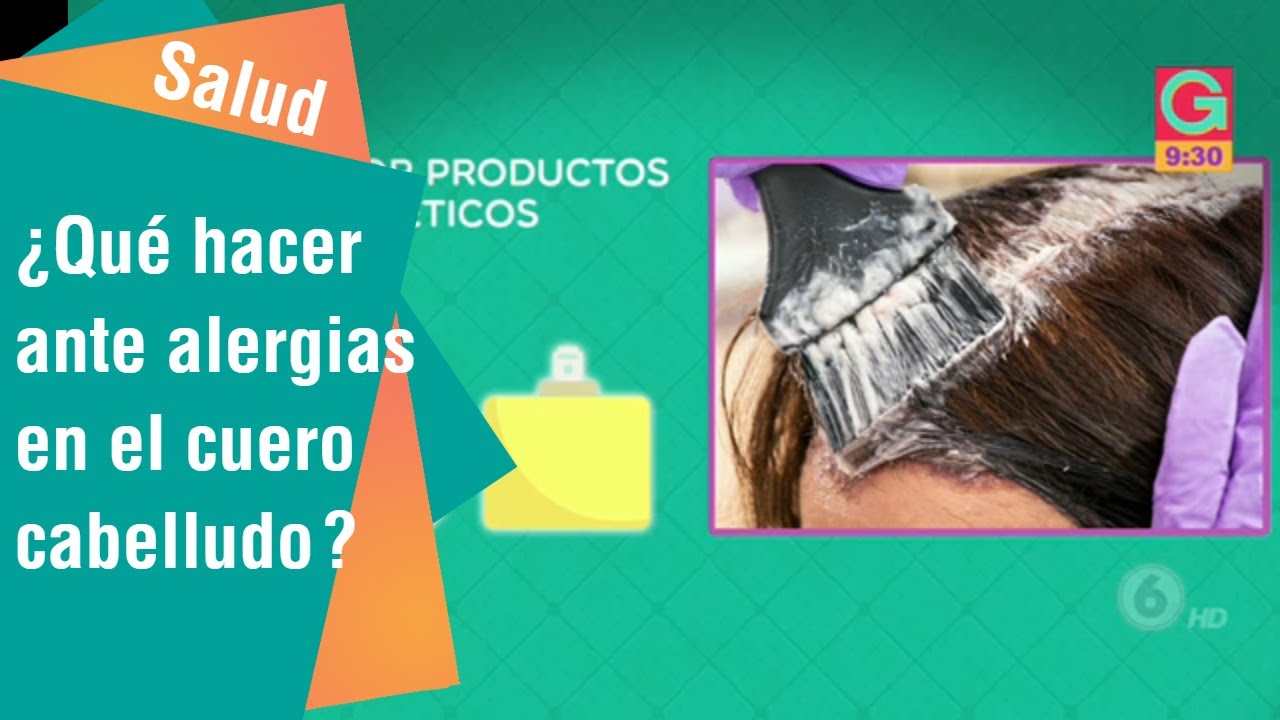 ¿Qué hacer ante alergias en el cuero cabelludo? | Salud