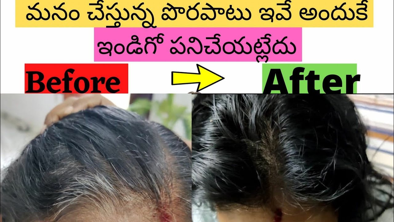 ఒక్క ప్రయత్నంలోనే 100% జుట్టును నల్లగా చేసే హెయిర్ డై | 100% effective remedy for white hair