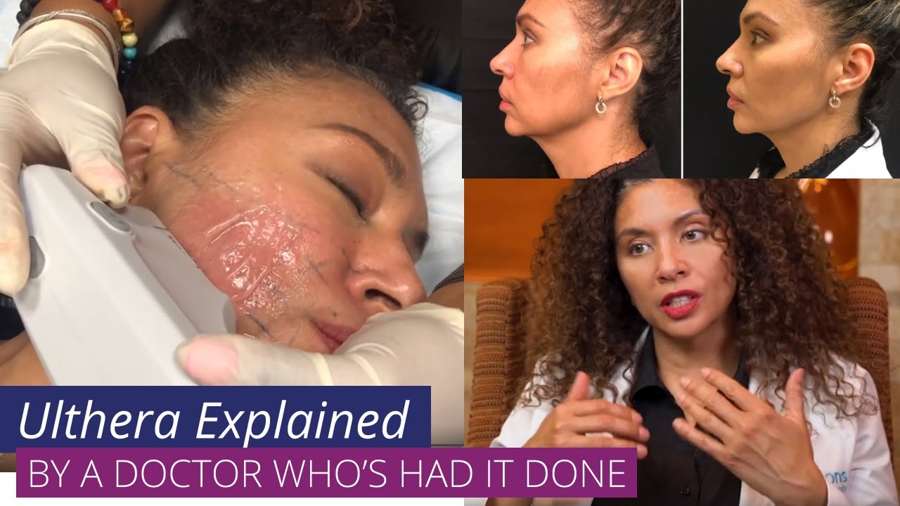 Ulthera (aka #Ultherapy ) Explained by a Doctor who's had #Ulthera herself
