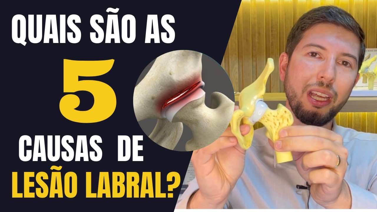 Quais são as 5 Causas de Lesão Labral?  | Dr Rafael Tavares