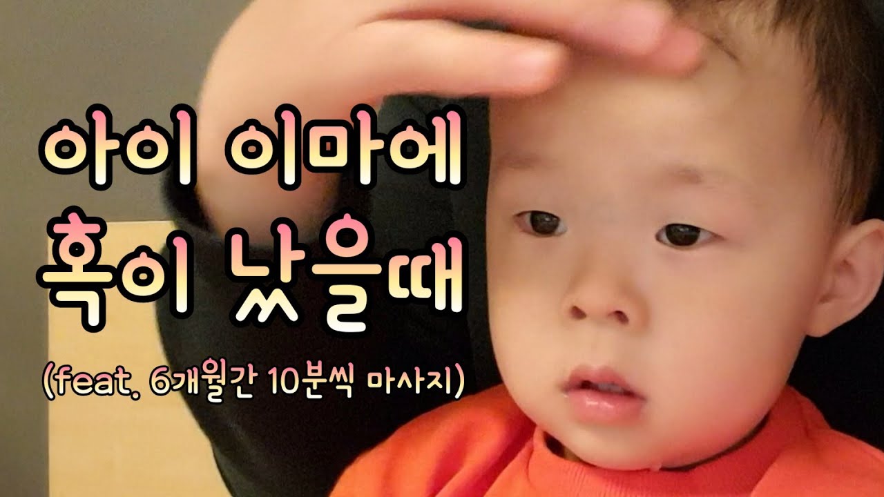 아이 이마에 혹이 났을때 (feat. 6개월간 10분씩 마사지)