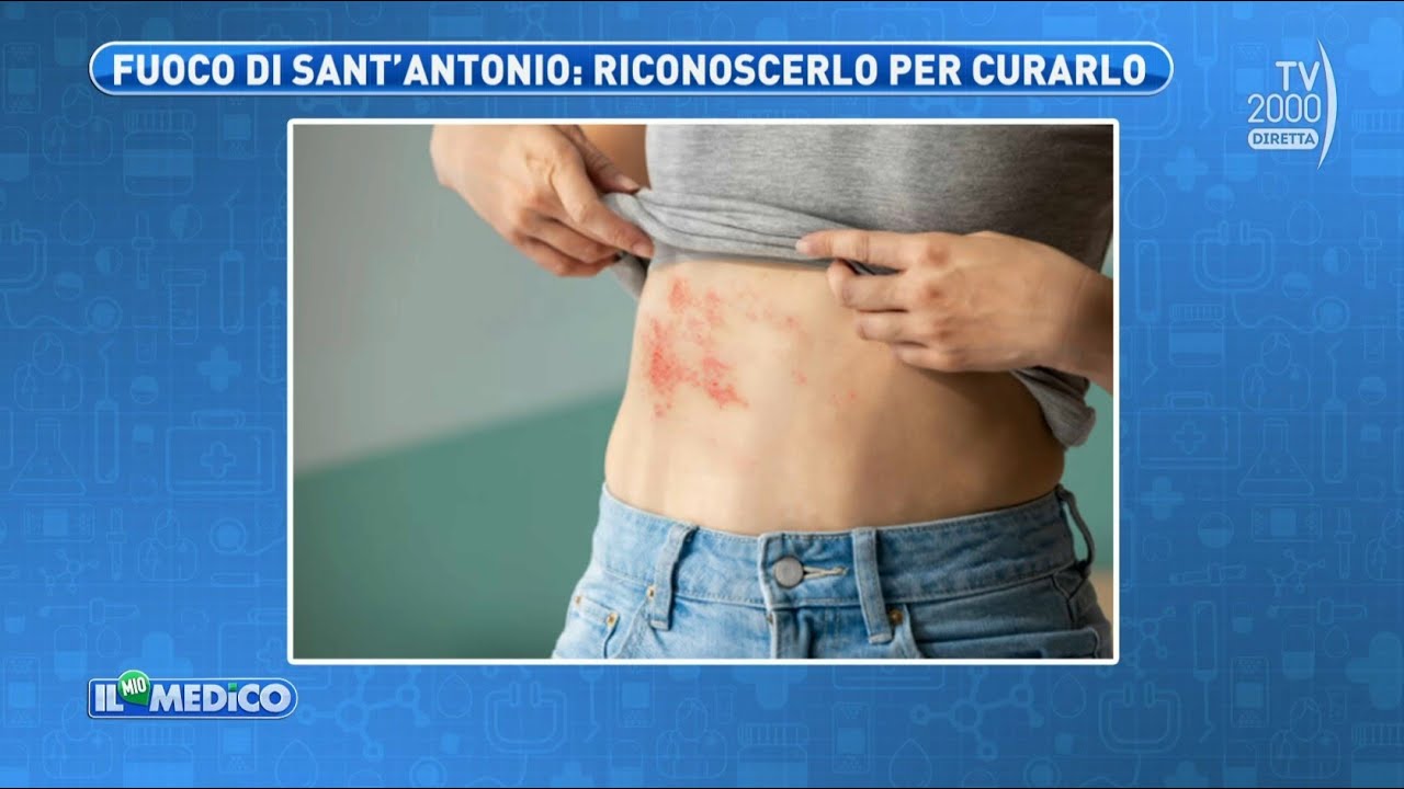 Il mio medico (TV2000) - Come riconoscere, curare e prevenire il fuoco di Sant’Antonio