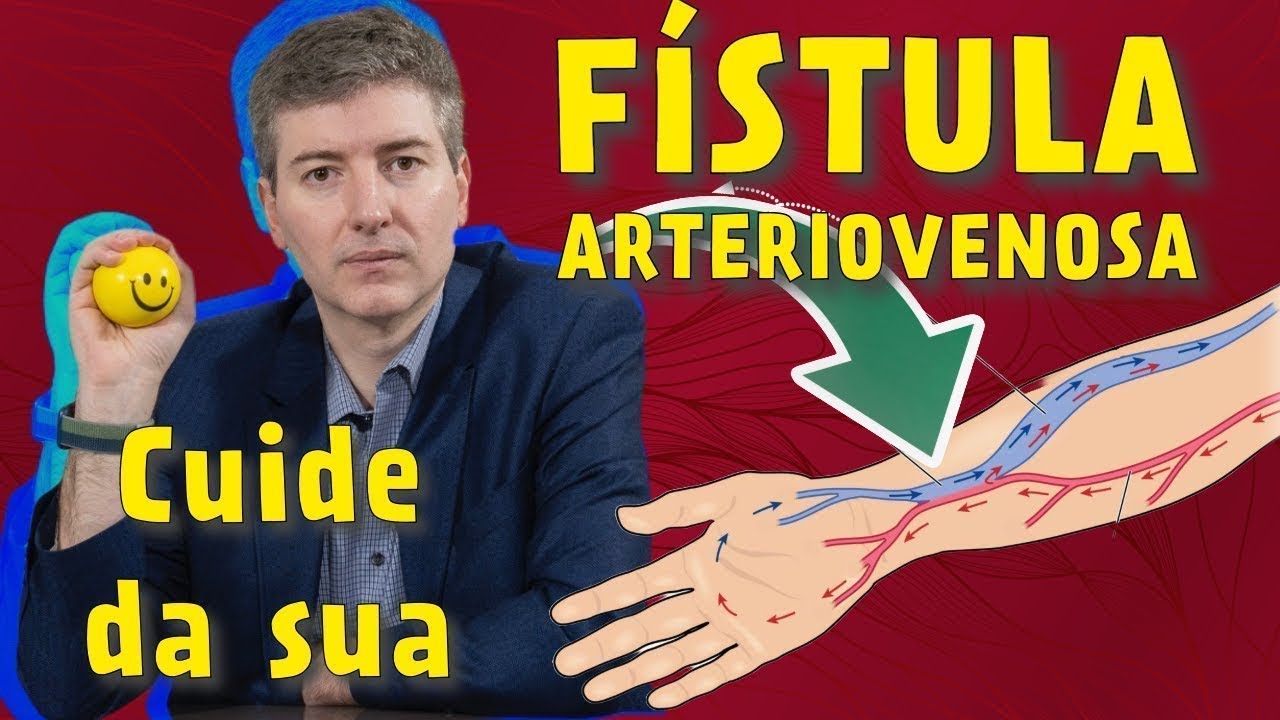 ❤️‍🩹 Sua Fístula Arteriovenosa Merece Atenção Total